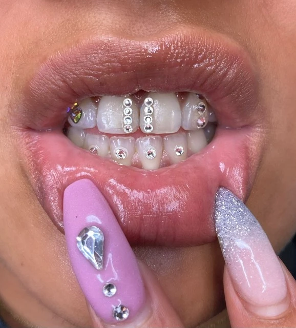Afspraak maken TOOTHGEMS