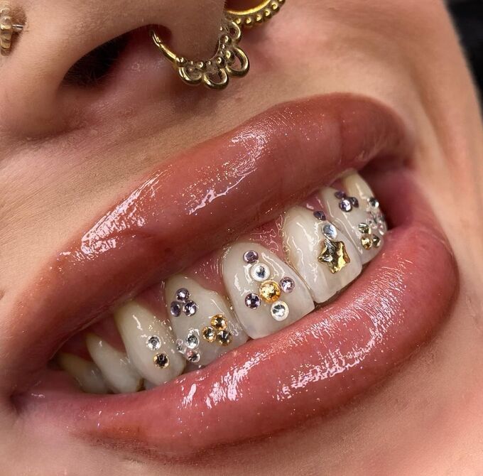 Toothgems