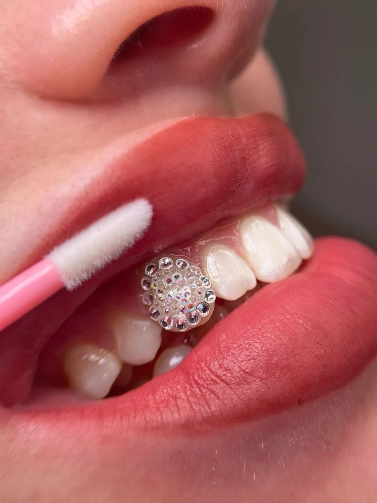 Afspraak maken TOOTHGEMS