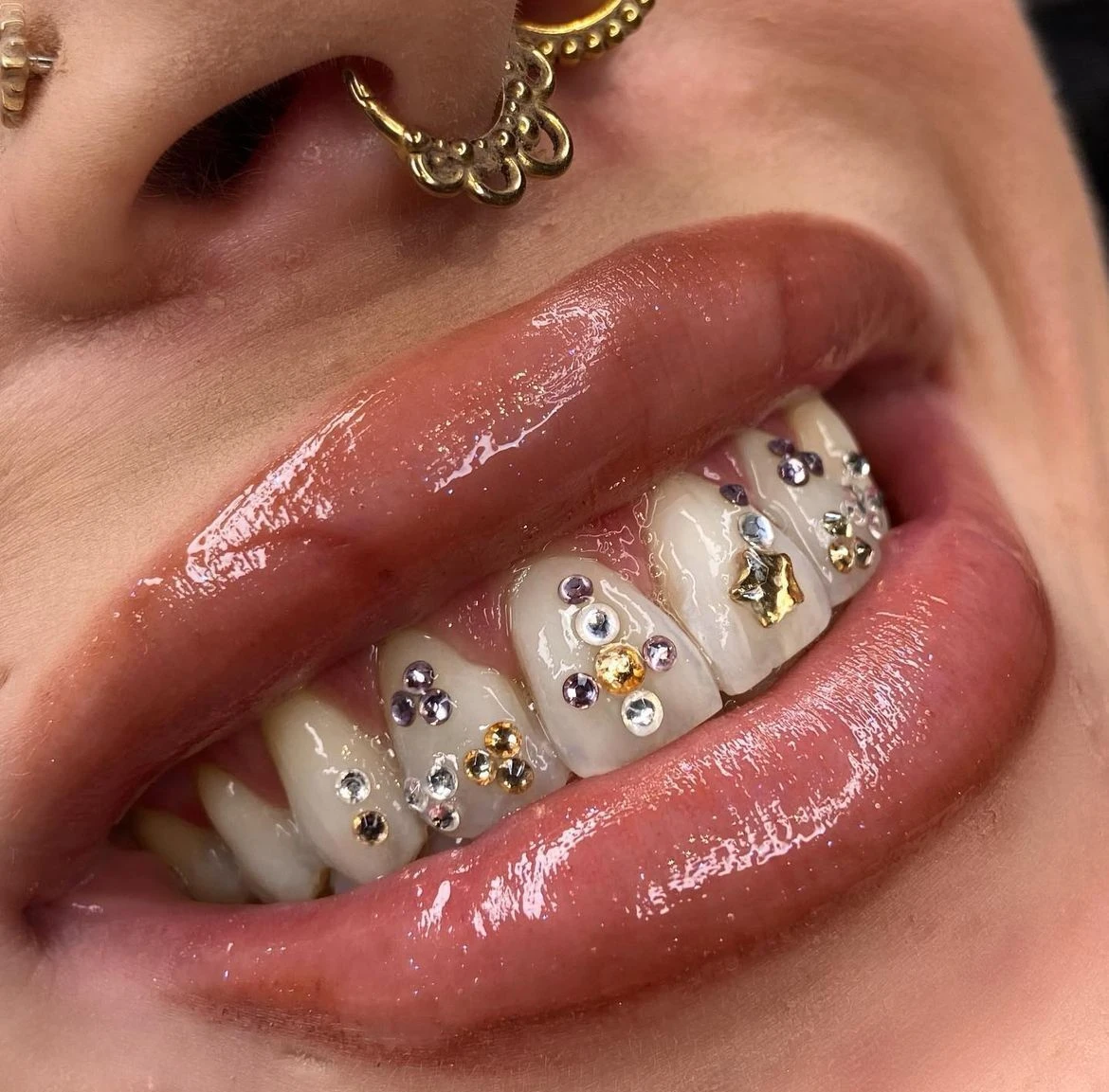 Afspraak maken TOOTHGEMS