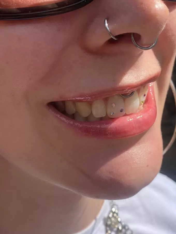 Afspraak maken TOOTHGEMS