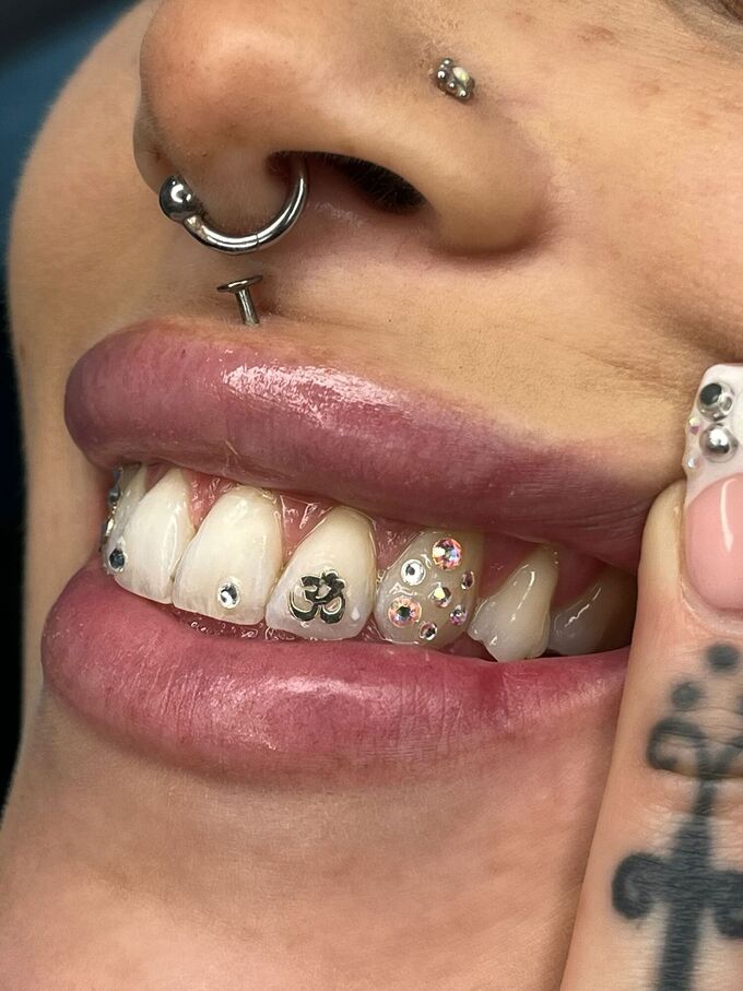 Toothgems