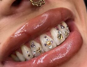 Toothgems